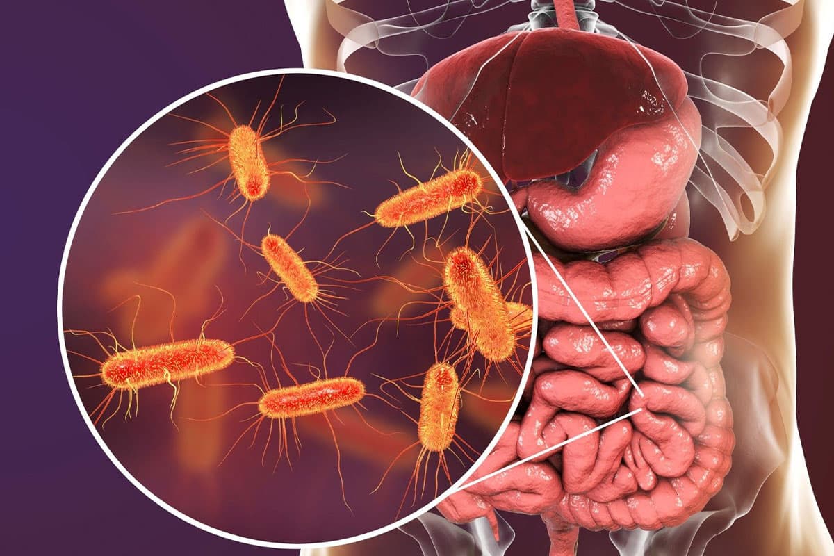 OR-MAN Bağırsak Florasını Güçlendirme – Sindirim Hassasiyeti Olanlar İçin Flora İnşası & Bağırsak Ekosistemi Protokolü